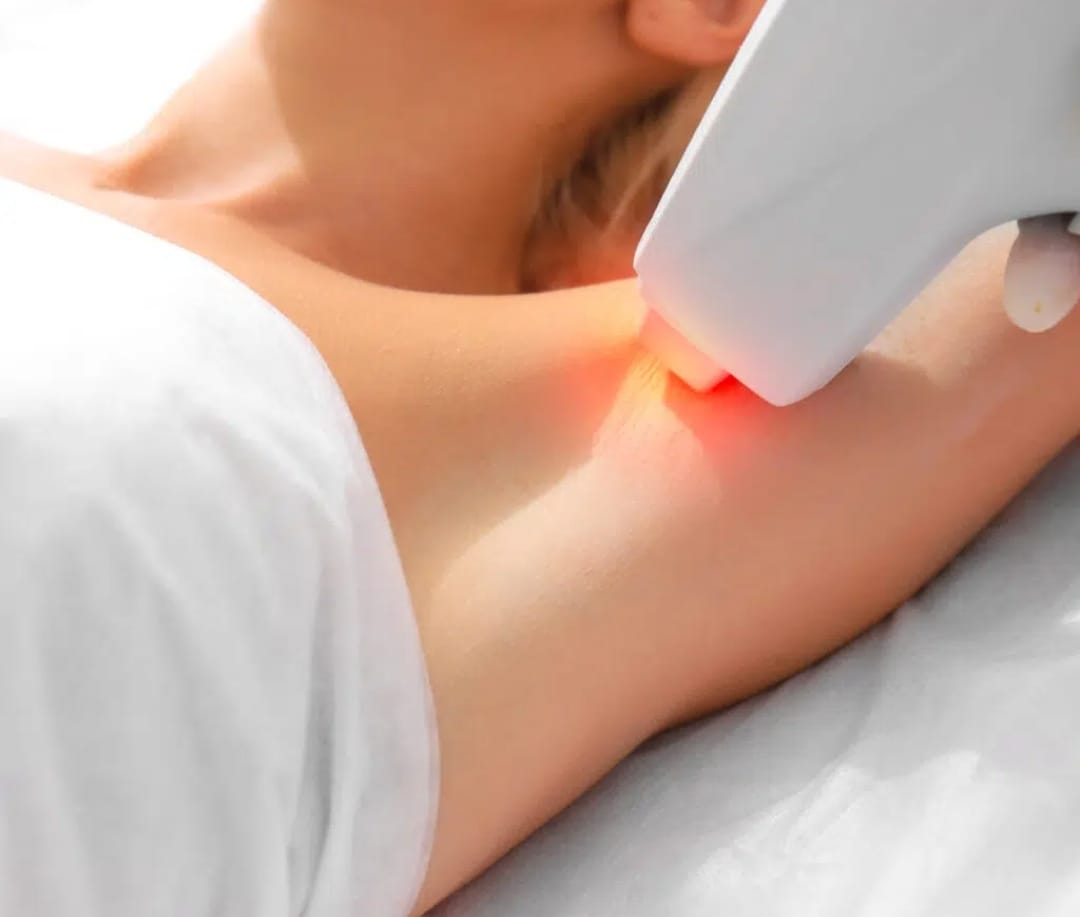 epilation definivite maison biote 2